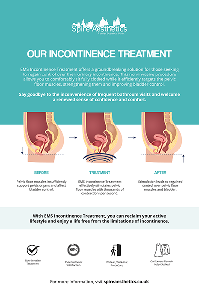 image to show how EMS treatment works for female urinary incontinence Camden