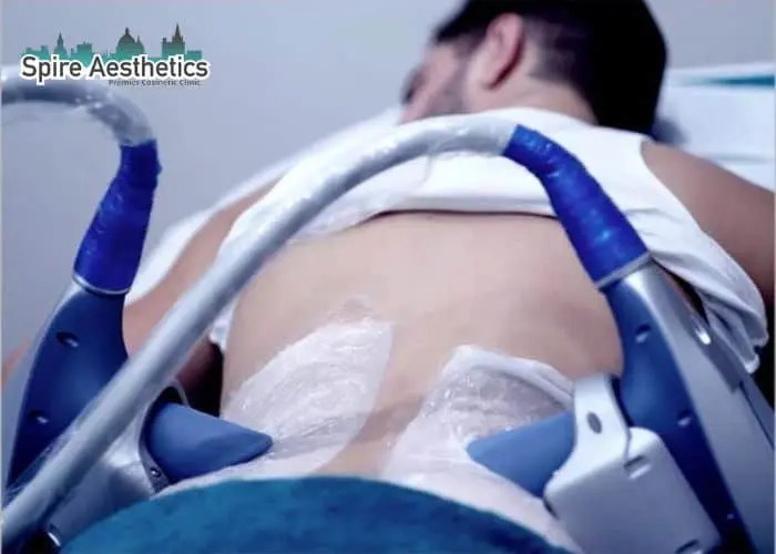 Man having fat freezing treatment done on love handles before a competitions Camden to create a sculpted look.