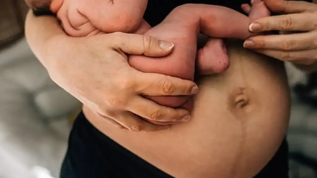 Why Is My Stomach Still Big After Pregnancy Camden?